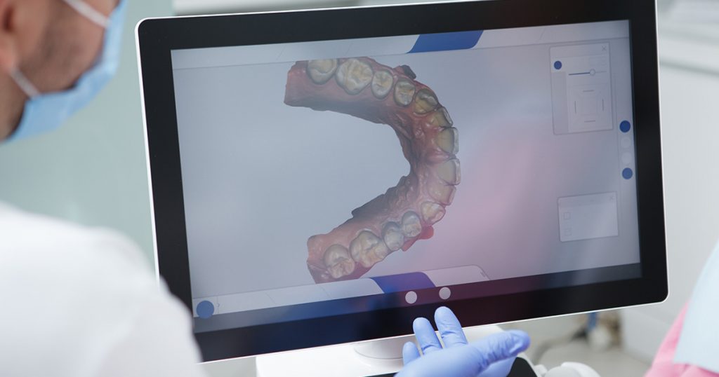 resultados do escaneamento intraoral digital