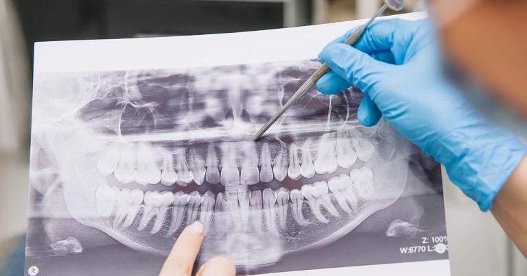 Cirurgia guiada: saiba os benefícios para pacientes de risco