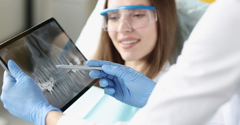 Raio-x digital odontológico: vantagens para o consultório