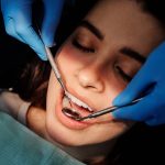 Implantes Imediatos: Colocando Dentes Artificiais no Mesmo Dia da Cirurgia