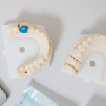 Pesquisadores desenvolvem tecnologia para usar IA generativa na fabricação inteligente de coroas dentárias